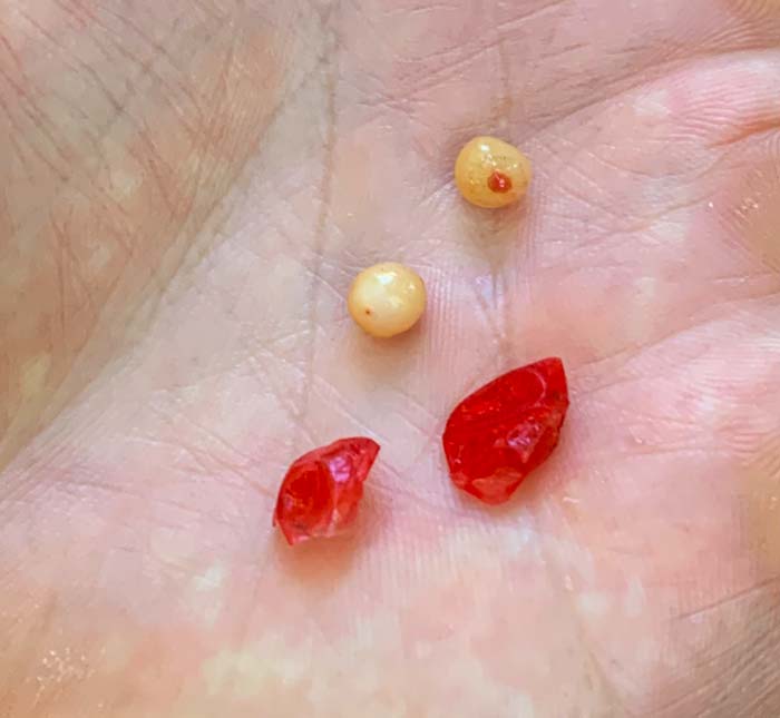 Each false Solomon's seal berry contains one large seed. 