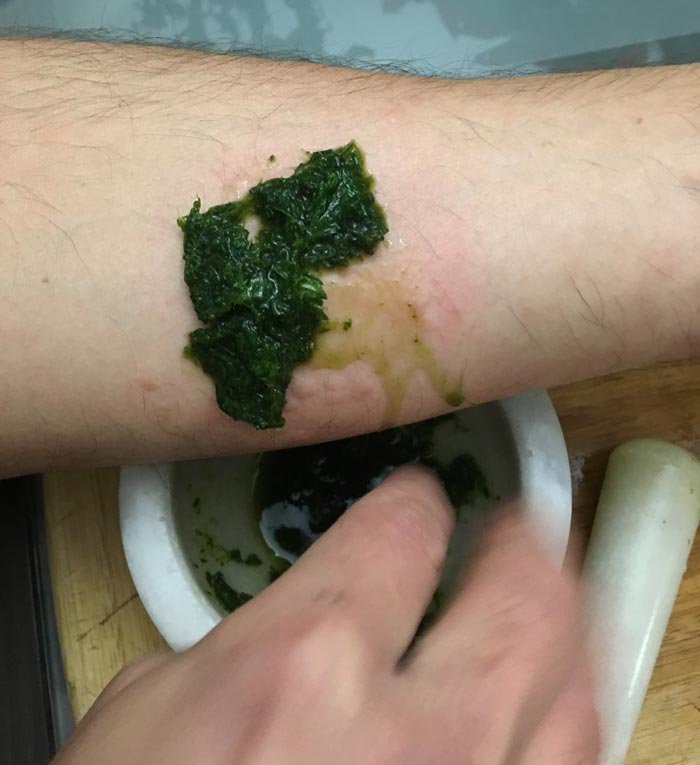 Pulverized stinging nettle and stinging nettle juice being applied to the nettle sting.